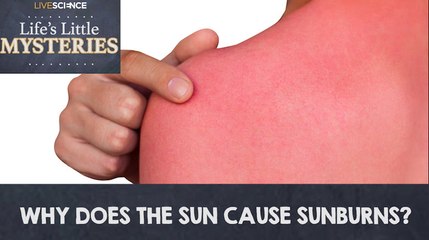 Life's Little Mysteries | Why Does the Sun Cause Sunburns?