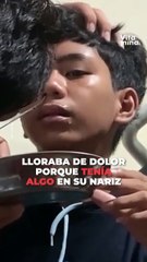 Sanguijuela en la nariz: Cómo actuar