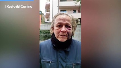 Picchiato a Bologna da una banda di ragazzini: il video