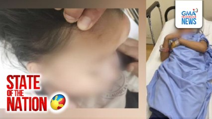 6-anyos, kritikal matapos umanong saktan ng ina ng kalaro | SONA