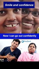 Best Smile Designing Treatment In Jaipur