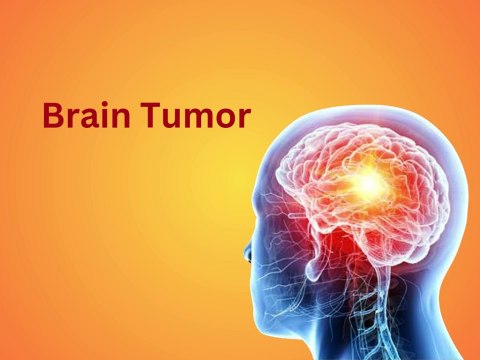 brain tumor and brain cancer in hindi | Complete information about brain tumor and brain cancer |