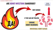 Why Kidney Infections Can Be DANGEROUS (Explained)?