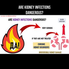 Why Kidney Infections Can Be DANGEROUS (Explained)?