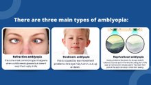 ✅ Amblyopia (Lazy Eye) ✅ Explained By Dr K Warraich ✅ #Amblyopia #lazyeye
