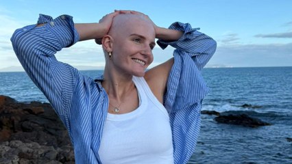 "I'm embracing my alopecia - I was diagnosed after my hair fell out in the shower"