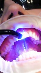 Smile confidently! Life-changing dental procedures explained!