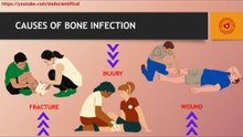 Causes of bone infection