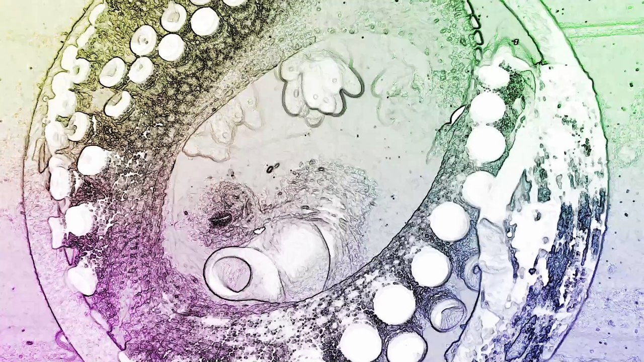 Why Do Octopuses Tear Themselves Apart After Mating?