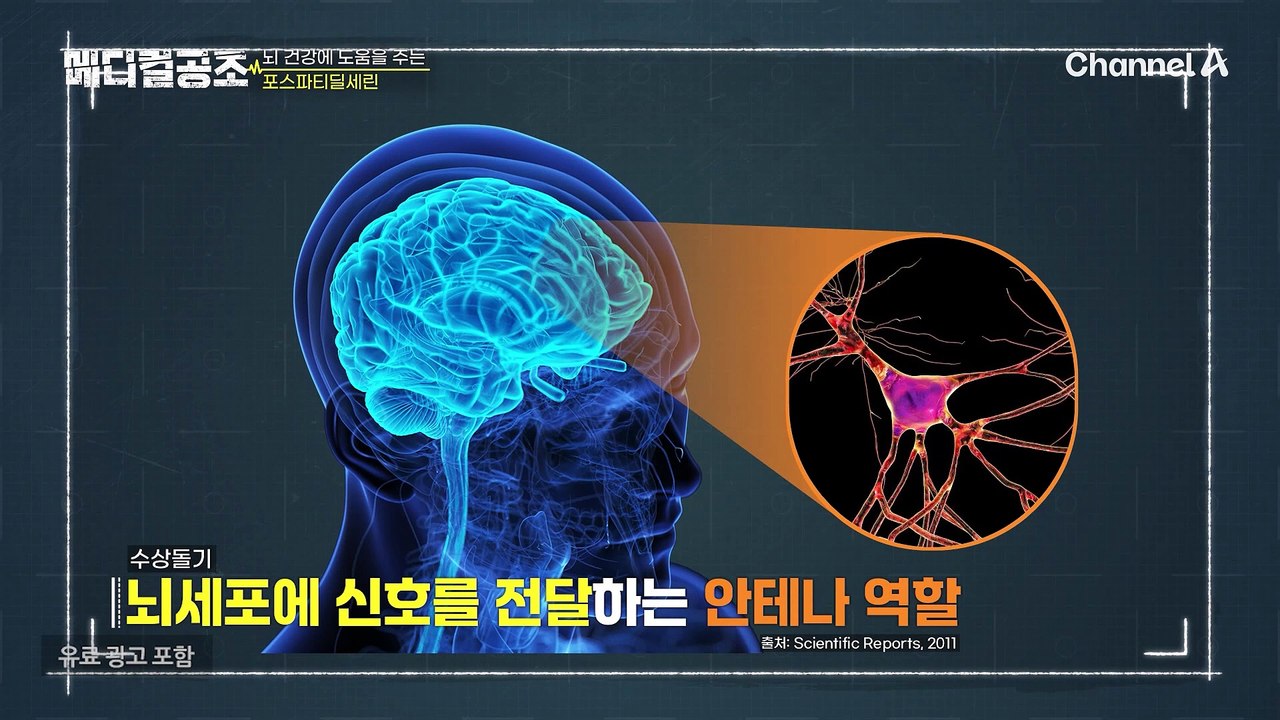 ↖경도인지장애를 극복↗ 하고 새로운 삶을 살고 있다는 그녀, 그녀가 뇌 건강을 지킬...
