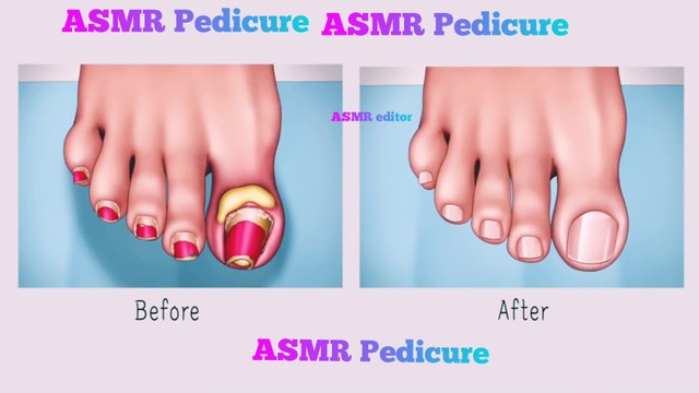 ASMR aura , sigmeaditior Chewing asmr satisfying asmrsounds asmrcommunity slime #oddlysatisfying #mukbang #satisfyingvideos #asmrvideo #asmreating #explorepage #asm food #slimeasmr #asmrsponge #mukbangasmr #