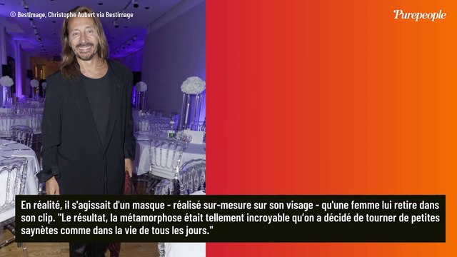 J’étais devenu un monstre physiquement : Bob Sinclar dit tout sur son visage transformé et explique les coulisses de sa métamorphose