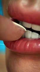 El vídeo que explica por qué no debes morderte las uñas