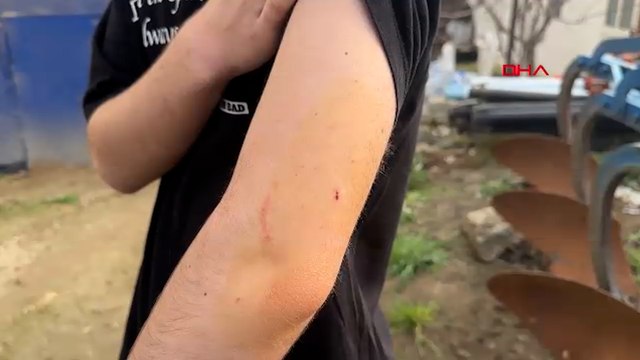 Okul yolunda köpek saldırdı; lise öğrencisi kolundan yaralandı