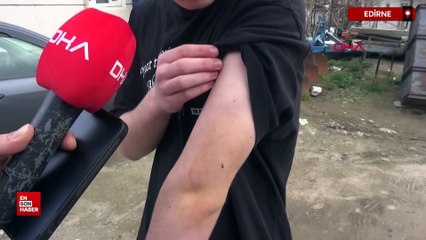 Edirne'de okul yolunda köpek saldırdı