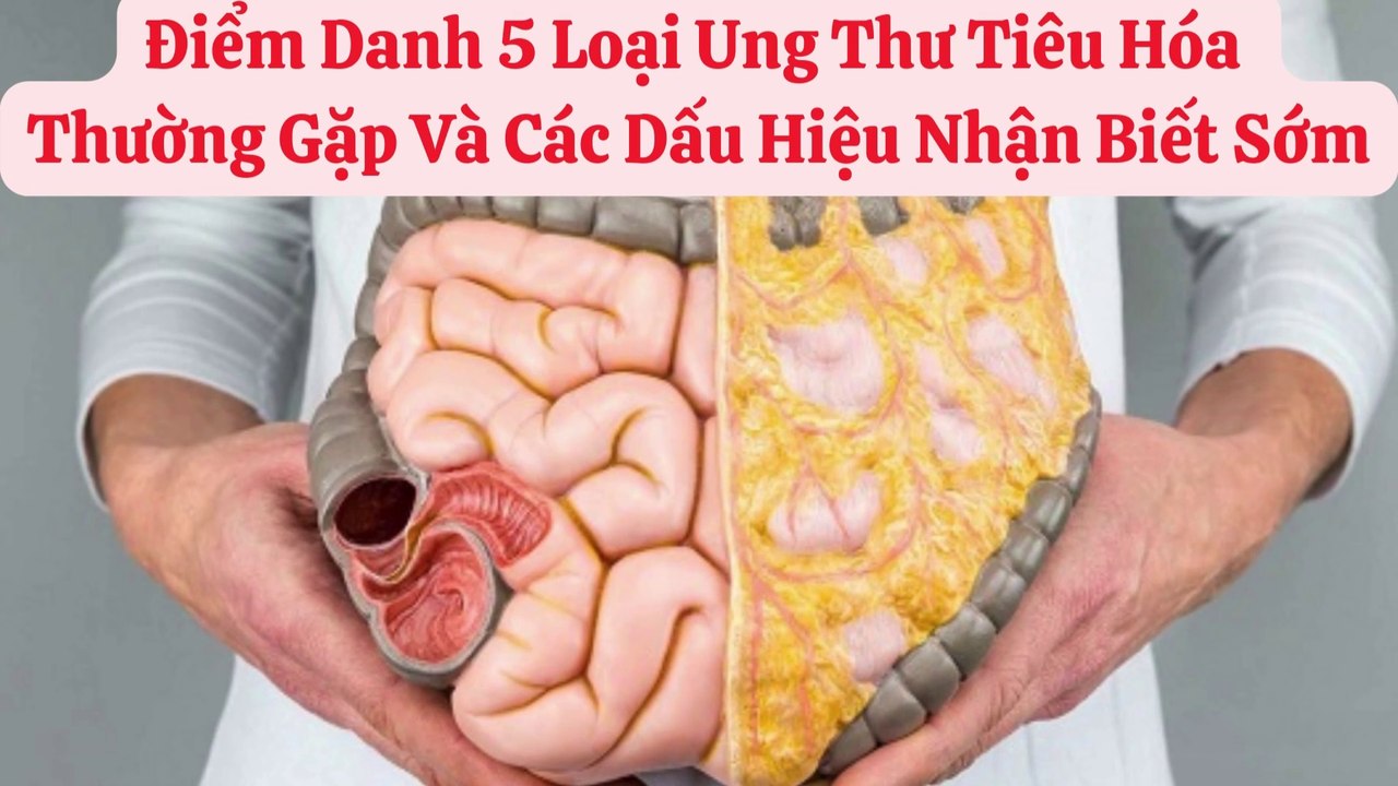 Điểm Danh 5 Loại Ung Thư Tiêu Hóa  Thường Gặp Và Các Dấu Hiệu Nhận Biết Sớm