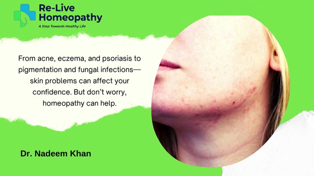 Title: Best Homeopathic Skin Doctor in Lucknow | Re-Live Homeopathy