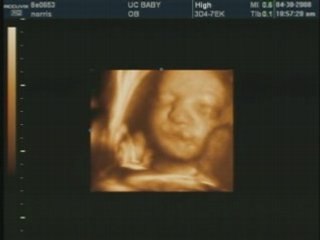 Owen 3D Ultrasound