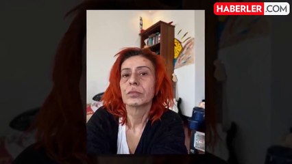 Yıldız Tilbe'nin yüzü yandı! Son halini paylaştı