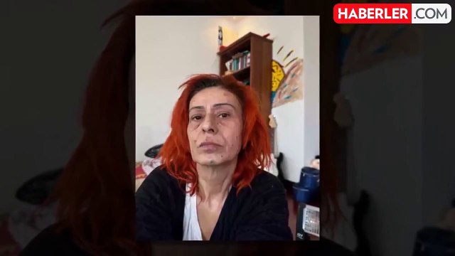 Yıldız Tilbe'nin yüzü neden yandı? Yıldız Tilbe'nin yüzü son hali nasıl?