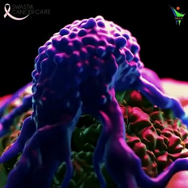 Targeted Therapy Result by Patient  Dr Deepak Singla Medical Oncologist  lung Cancer  #feedback