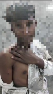 नाबालिग को कुत्ते से कटवाकर बदमाशों ने लूटे 50 हजार रुपए, देखें VIDEO