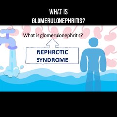 Glomerulonephritis Explained: Causes, Symptoms & Treatment 🩺