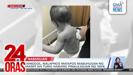 Sanggol, nalapnos matapos mabuhusan ng mainit na tubig habang pinaliliguan ng yaya | 24 Oras