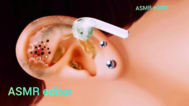 ASMRsperinnsoft speaking/whispering, gentle hand movements, hair brushing, tapping sounds, crinkling paper, ear-cleaning sounds, light scratching, mouth sounds like lip smacking or chewing, keyboard typing, sponge/foam manipulation, water pouring, pa