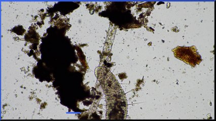 The Tapeworm Diet: What You Need to Know 🐛