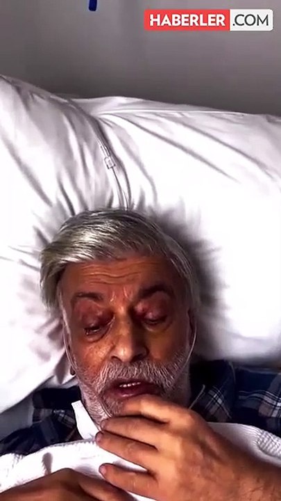 Kahtalı Mıçe kanser mi? Kahtalı Mıçe hastalığı ne?