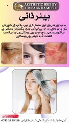 Hair Dye || Aesthetic Hub Dr. Saba Hameed ||