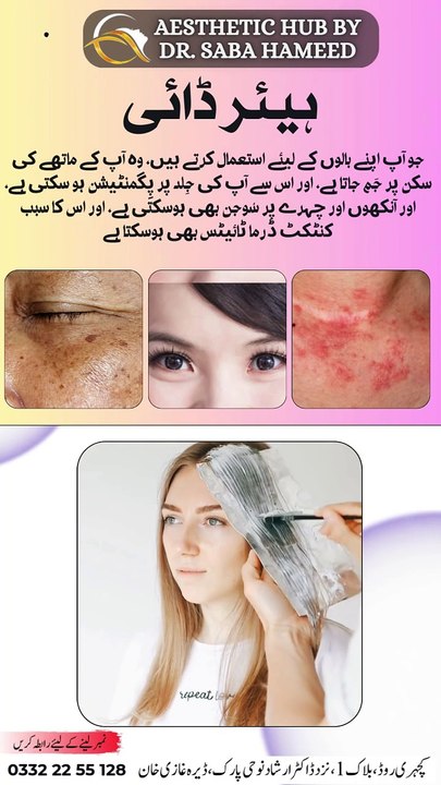 Hair Dye || Aesthetic Hub Dr. Saba Hameed ||
