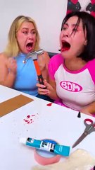 Fake Wisdom Tooth Extraction Prank 🦷😂 #123go