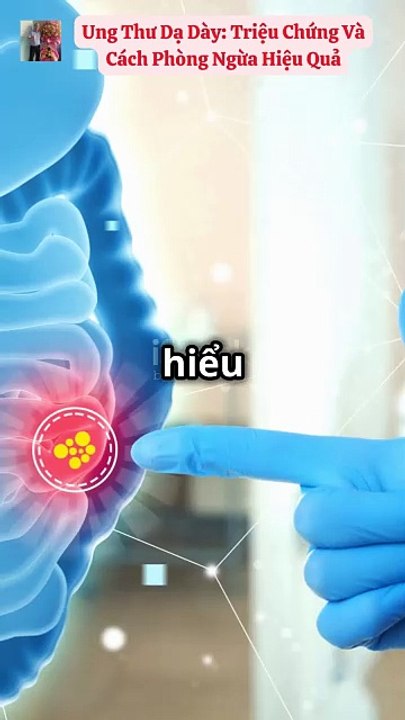 Ung thư dạ dày Triệu chứng và cách phòng ngừa hiệu quả