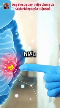 Ung thư dạ dày Triệu chứng và cách phòng ngừa hiệu quả