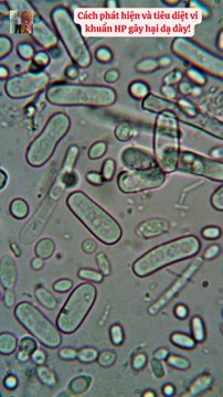 Cách phát hiện và tiêu diệt vi khuẩn HP gây hại dạ dày!