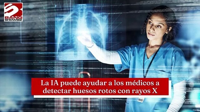 La IA puede ayudar a los médicos a detectar huesos rotos con rayos X