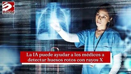 La IA puede ayudar a los médicos a detectar huesos rotos con rayos X