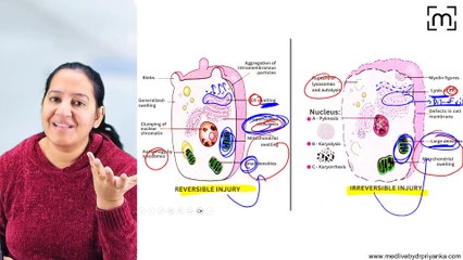 3.Morphological changes Reversible and Irreversible cell injury