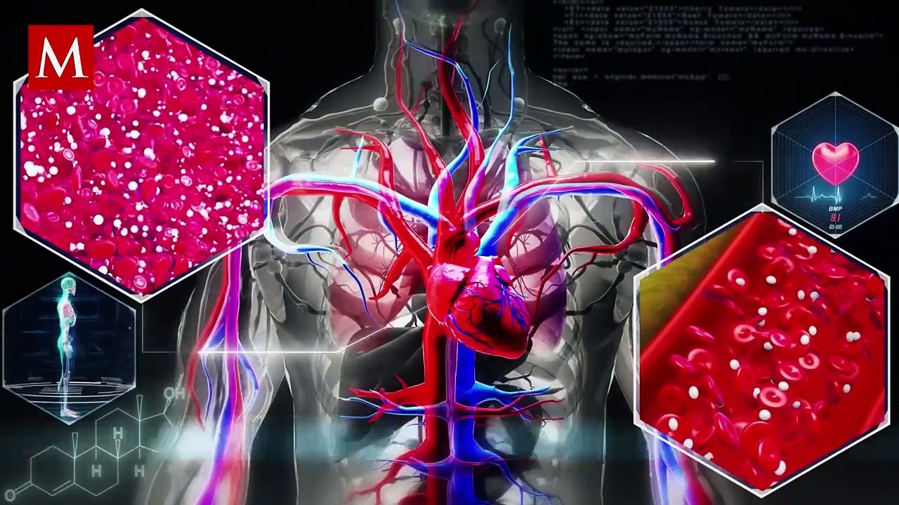 ¿Qué es la trombosis pulmonar? Posible causa de la nueva hospitalización de Daniel Bisogno