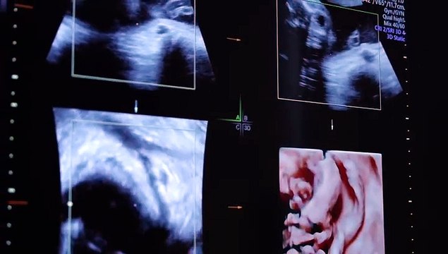 Çocuk sahibi olmak isteyenlere müjde! Tüp bebek tedavisinde başarı oranı yüzde 80’e ulaştı