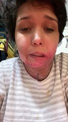 Liliana sigue sin recibir justicia; sufrió tentativa de feminicidio