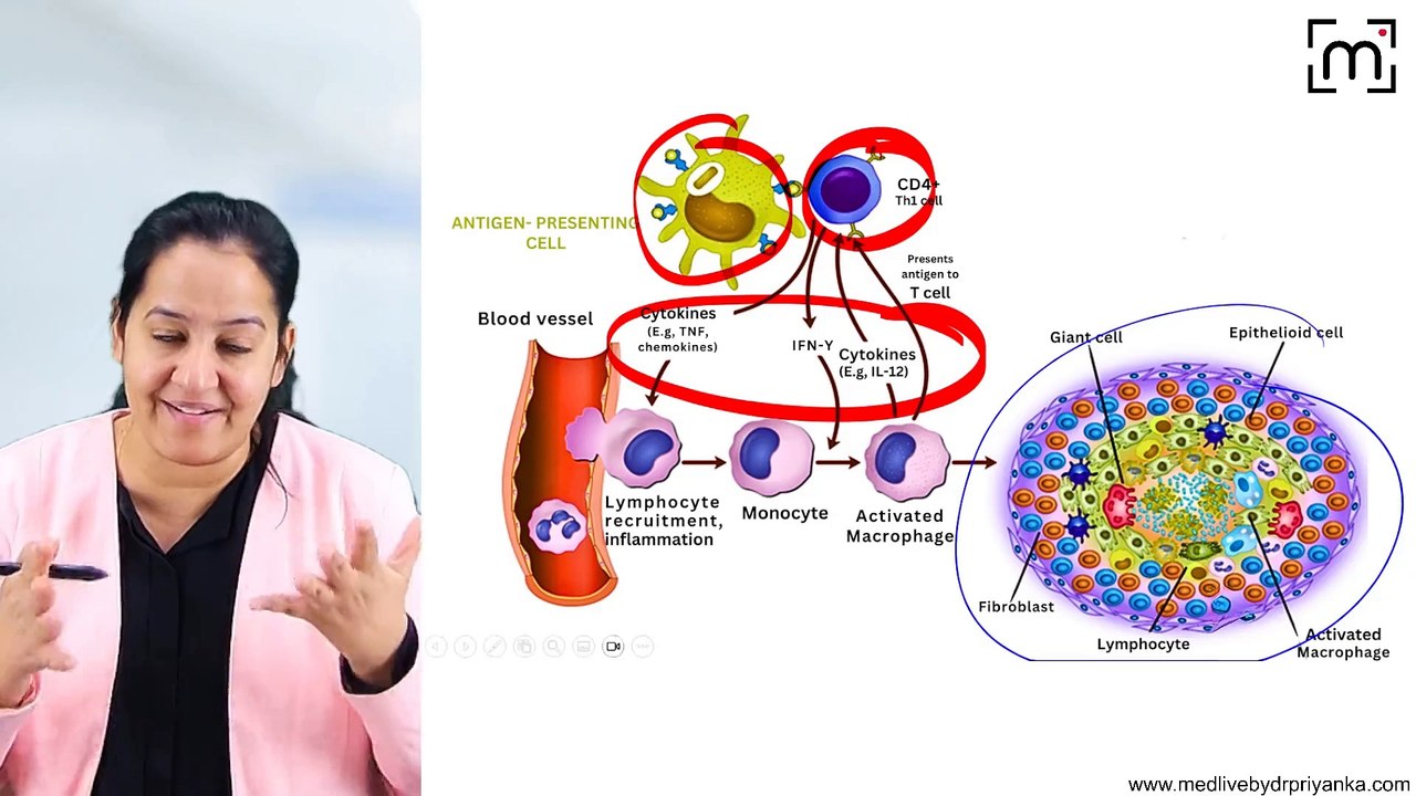 3. Chronic Inflammation or Granulomatous Inflammation