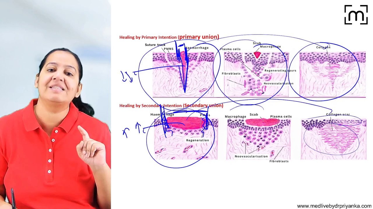 2. Healing by 1°&2°Intention