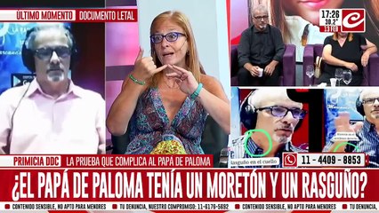¿El papá de Paloma tenía un moretón y además un rasguño?