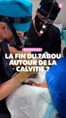 Reportage : Greffe de cheveux