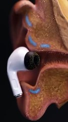 Your Earbuds Could Be Causing Ear Infections! Here’s Why 🦠👂#infection #earbuds