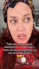 ¿Es pidaña?: mujer relata accidente con dientes terroríficos (VIDEO)