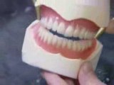 Prothèses dentaires - comment c'est fait ?